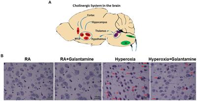 Galantamine ameliorates hyperoxia-induced brain injury in neonatal mice